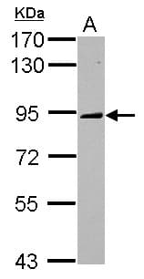 KIF2C / MCAK Antibody