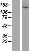 CFAP61 / C20orf26 Protein (Over-Expression Lysate Myc-DDK (Flag))