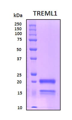 Human TREML1 / TLT1 Protein (Recombinant His, N-Terminal)