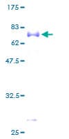 Human FCER2 / CD23 Protein (Recombinant GST)