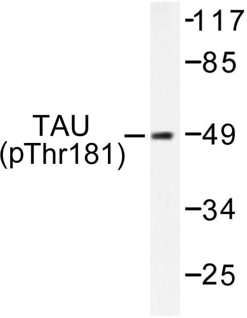 MAPT / Tau Antibody (phospho-Thr181)