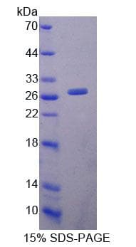 Mouse LYPLA1 Protein (Recombinant His-T7)