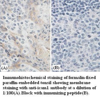 Polyclonal Rabbit anti-Human ICAM-1 / CD54 Antibody (IHC)