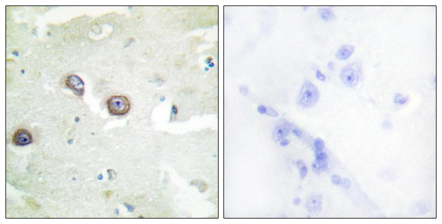 Polyclonal Rabbit anti-Human CDH4 / R Cadherin Antibody (IHC, IF)