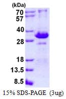 Human TIRAP Protein (Recombinant His)