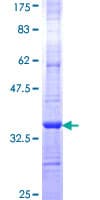 Human GALC / Galactocerebrosidase Protein (Recombinant GST, N-terminus)