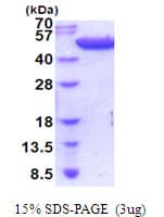 Human tnAaA Protein (Recombinant His)