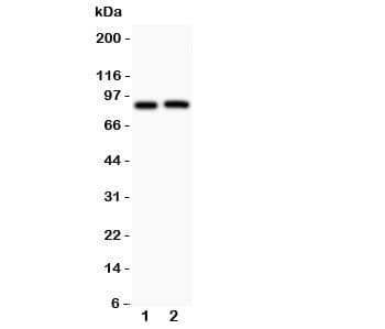 Beta Amyloid Antibody (aa672-702)