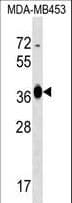 GFOD2 Antibody (aa277-305)