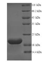 Human GPR75 Protein (Recombinant 6His, N-terminus)