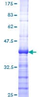 Human MEN1 / Menin Protein (Recombinant GST, N-terminus)