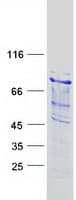 Human INTS9 Protein (Recombinant Myc-DDK (Flag))