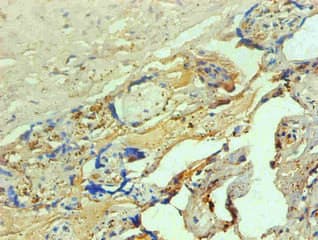 Monoclonal Mouse anti-Human Hemoglobin Antibody (clone 4A1B1, IHC)