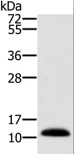Polyclonal Rabbit anti-Human MSMB / MSP Antibody (IHC, WB)