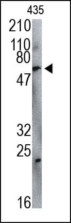 COIL / Coilin Antibody