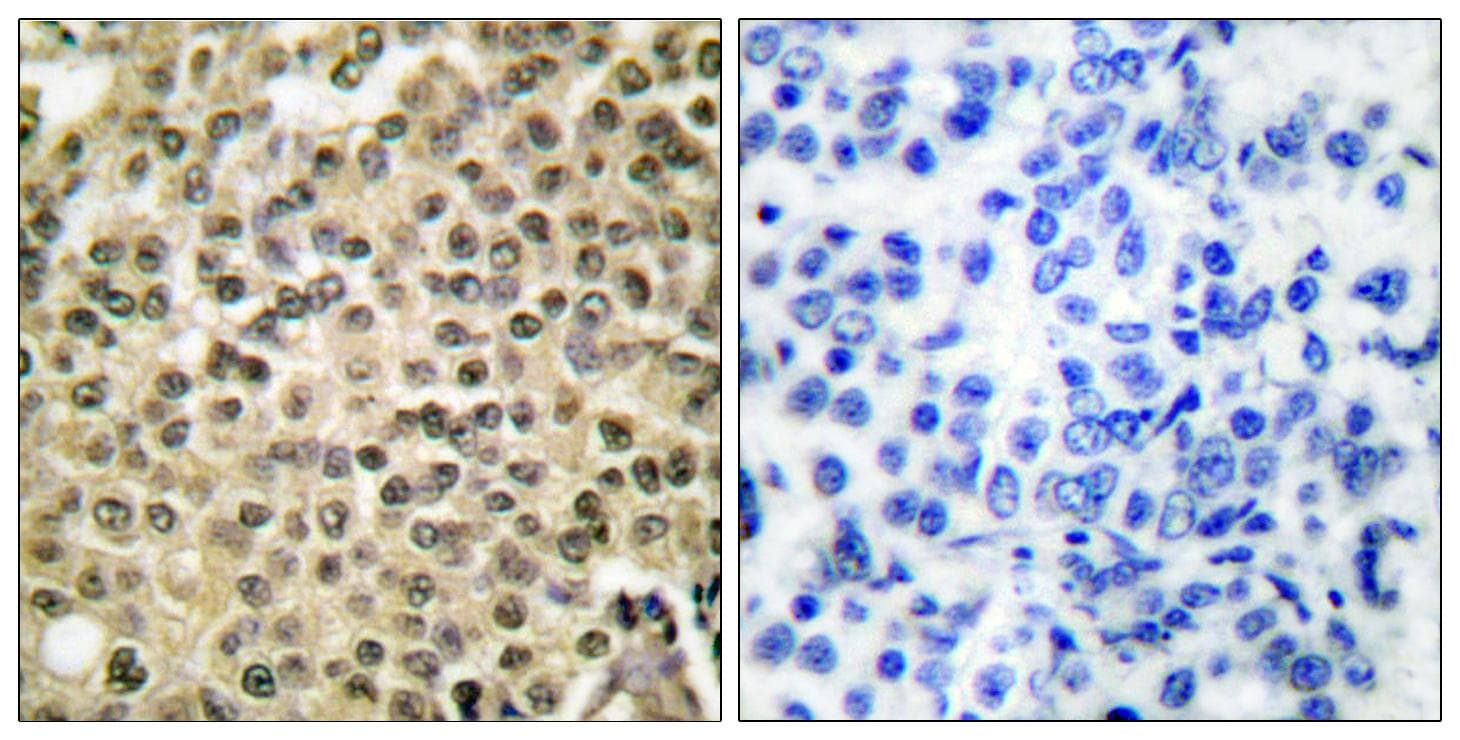 RAN Antibody