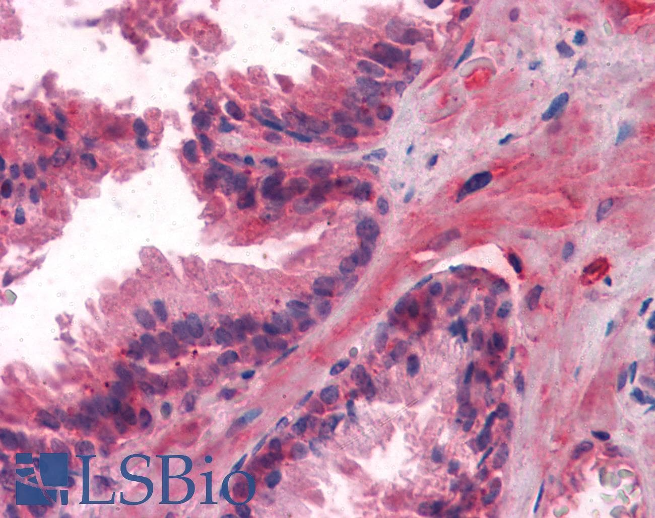 IHC-plus™ LCN1 / Lipocalin-1 Antibody (clone 10B10)