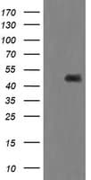 MAP2K1 / MKK1 / MEK1 Antibody (clone OTI3H5)