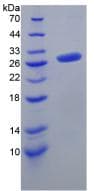 Mouse FGF23 Protein (Recombinant His, N-Terminal)