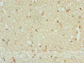 CAMK2B / CaMKII Beta Antibody