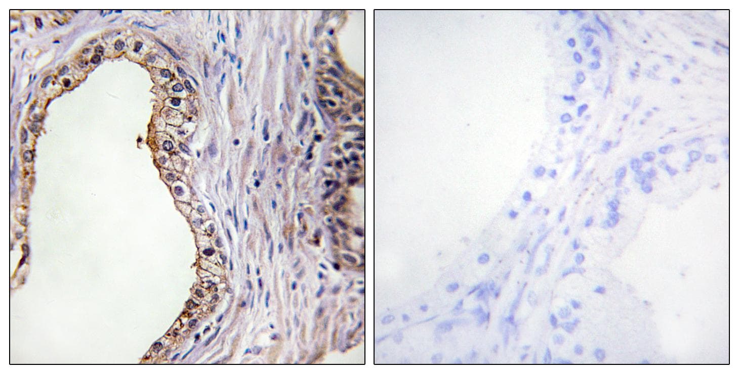 LRAT Antibody