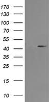 MAP2K1 / MKK1 / MEK1 Antibody (clone OTI1F9)