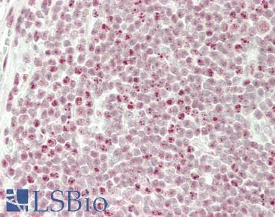 IHC-plus™ Polyclonal Rabbit anti-Human TAL1 Antibody (aa67-116, IHC, WB)