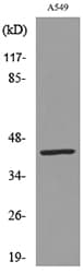 KRT19 / CK19 / Cytokeratin 19 Antibody