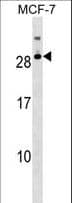 RNASE11 Antibody (aa68-95)