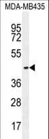 OR2L13 Antibody (aa244-271)