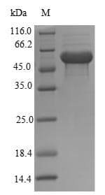 Mouse TXNIP Protein (Recombinant 6His-B2M, N-terminus)