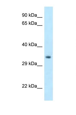 HOXC11 Antibody (C-Terminus)