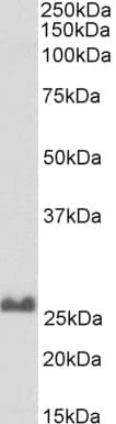 Polyclonal Goat anti-Human SNAP25 Antibody (Biotin, C Terminus, IHC, WB)