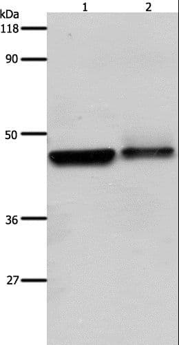 Polyclonal Rabbit anti-Human ADRB2 Antibody (IHC, WB)