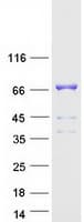Human DLAT / PDC-E2 Protein (Recombinant Myc-DDK (Flag))