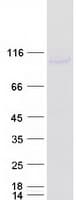 Human DDX20 / GEMIN3 Protein (Recombinant Myc-DDK (Flag))