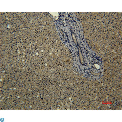 TF / Transferrin Antibody