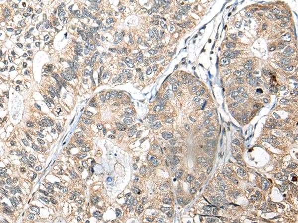 SLAMF7 / CRACC Antibody
