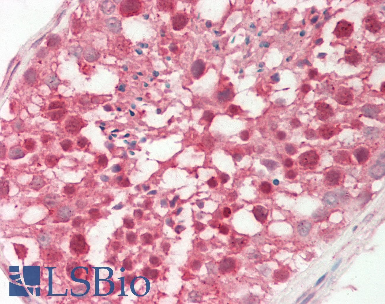 PathPlus™ PDGF-CC Antibody (N-Terminus)