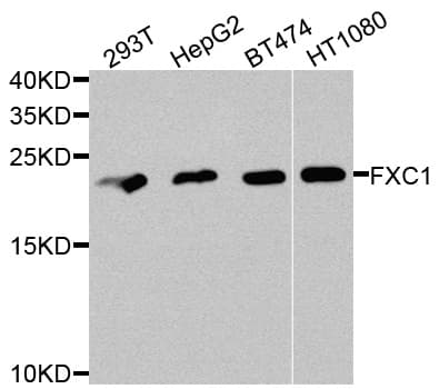 Polyclonal Rabbit anti-Human TIMM10B / FXC1 Antibody (IHC, WB)