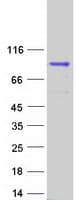 Human DUS3L Protein (Recombinant Myc-DDK (Flag))