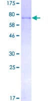 Human F9 / Factor IX Protein (Recombinant GST)