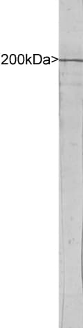 Polyclonal Rabbit anti-Human NEFH / NF-H Antibody (IF, WB)
