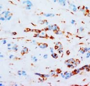 JUP/CTNNG/Junction Plakoglobin Antibody (N-Terminus)