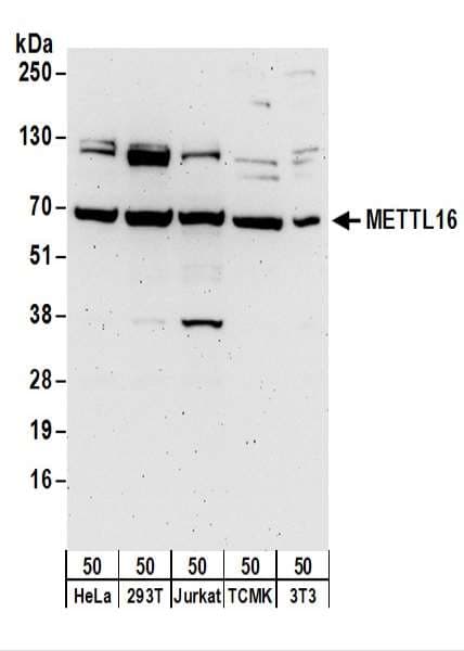 METTL16 / METT10D Antibody (aa375-425)
