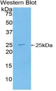 TICAM2 / TRAM Antibody (aa22-205, FITC)