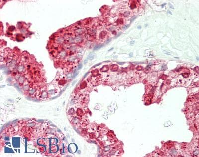 PathPlus™ ACPP / PAP Antibody (aa215-264)