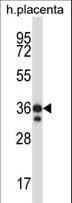 STK26 / MST4 Antibody (aa271-299)