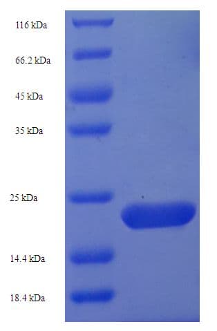 Human AQP4 / Aquaporin 4 Protein (Recombinant His-SUMO)