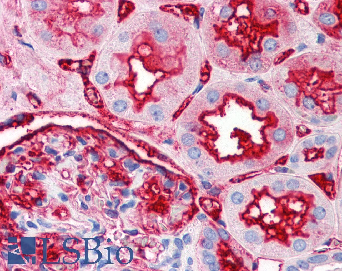 IHC-plus™ TNFRSF12A / TWEAK Receptor Antibody